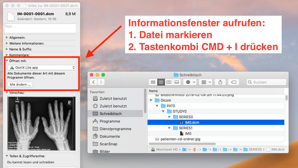 Über das Informationsfenster im Finder (MAC) läßt sich festlegen, dass dcm-Dateien in Zukunft immer mit dem OsiriX DICOM Viewer geöffnet werden.