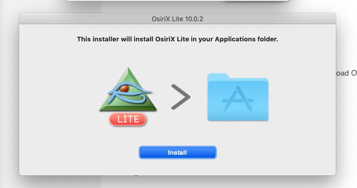 Bei der Installation von OsiriX Lite erwartet der Mac die Eingabe des Admin-Passworts.